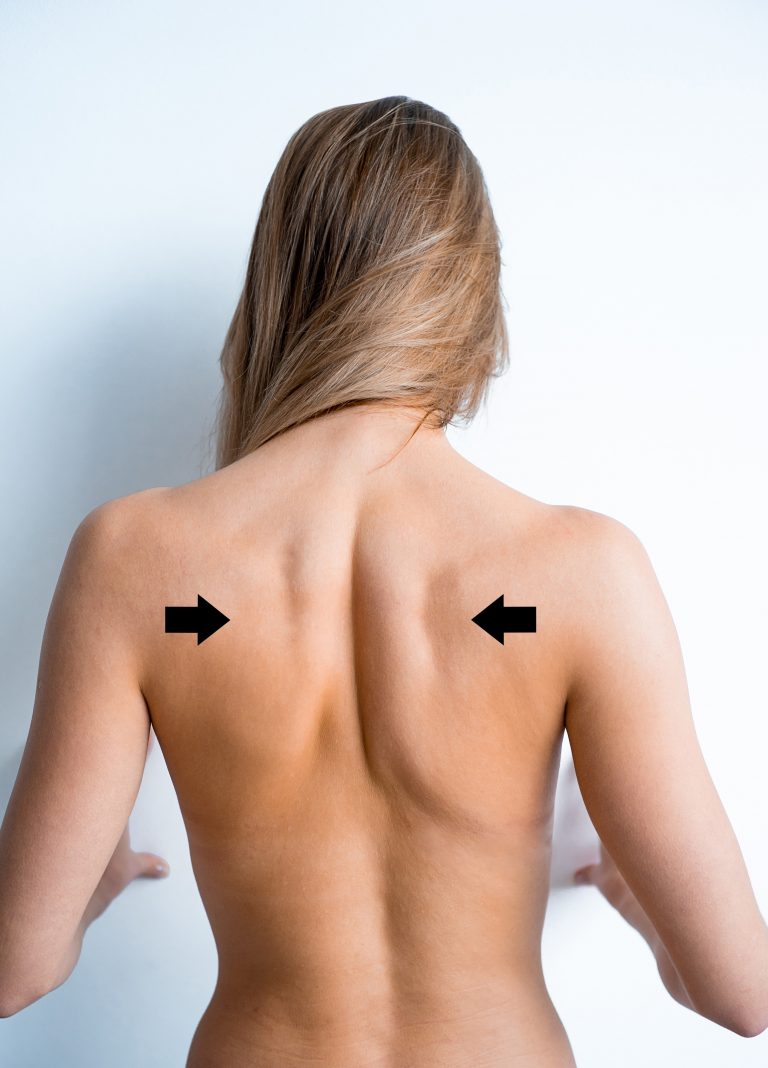 Shoulder Blades Pinching