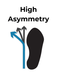 Shoe icon depicts high asymmetry with a blue arrow