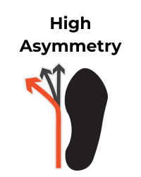 Shoe icon depicts high asymmetry with a red arrow
