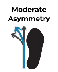 Shoe icon depicts moderate asymmetry with a blue arrow