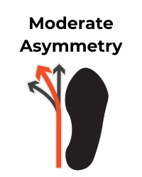 Shoe icon depicts moderate asymmetry with a red arrow