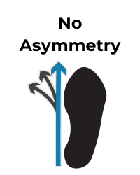 Shoe icon depicts no asymmetry with a blue arrow