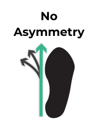 Shoe icon depicts no asymmetry with a green arrow